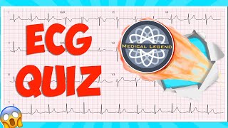 Are You A Medical Legend Test Your Knowledge With This Ecgekg Quiz electrocardiogram [upl. by Ahsaeym512]