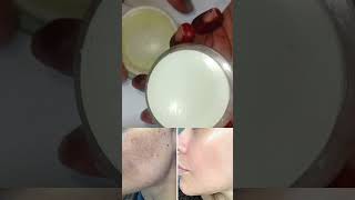 Best pigmentation removal cream 😯pigmentationsolution pigmentation pigmentationtreatmentathome [upl. by Yelsnik]