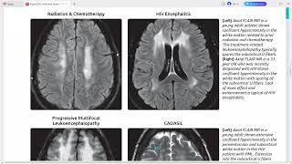 EXPERT DDX BRAIN AND SPINE IMAGING [upl. by Carmelina]