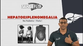 Hepatoesplenomegalia  Parte 1 Funções do fígado e baço etiologias e mais  Aula SanarFlix [upl. by Nylirem]