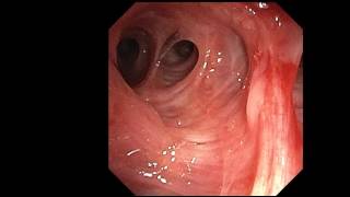 Bronchoscope simulator [upl. by Elijah]