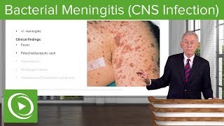 Bacterial Meningitis CNS Infection – Infectious Diseases  Lecturio [upl. by Idolem48]