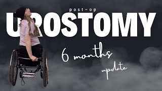 6 Months PostOp Urostomy Do I regret it [upl. by Nealson]