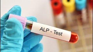 Alkaline phosphatase ALP Test procedure [upl. by Aznola]