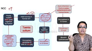 E6 Sample Video Toxoplasmosis and Neurocysticercosis Microbiology [upl. by Constantino]