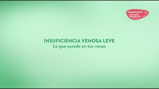 Insuficiencia venosa leve [upl. by Lekim]