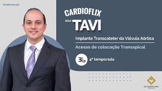 TAVI  Acesso de colocação Transapical Episódio 3 [upl. by Brooking240]