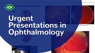 Essential Eyes urgent presentations in ophthalmology Fri 01 Feb [upl. by Heater]