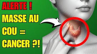 Jai Découvert Ces 5 Signes de Cancer de la Thyroïde à Ne Pas Ignorer  🚨✨ Prévention Santé [upl. by Anom]