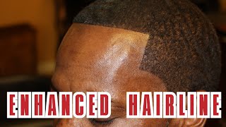 How to Apply Toppik Hair Fibers  Crispy Shape Up [upl. by Airehs]