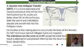 Assisted Reproductive Technologies ART [upl. by Weylin856]