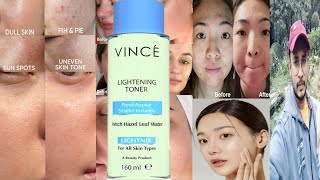 Vince Lightening Toner  Honest Review [upl. by Jackquelin632]