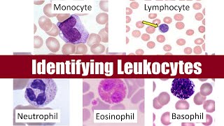 Identifying Leukocytes [upl. by Nywde]