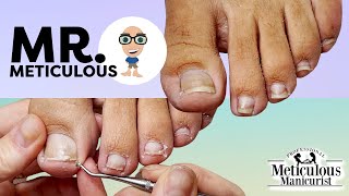 Mr Meticulous Pedicure Tutorial Impacted Toenails with ASMR [upl. by Belden170]