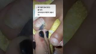 How to Get Deep Corners of FeetNail Cutting Techniques for Hands and Feet for Beginners nail​​​ [upl. by Snook]