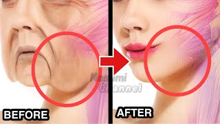 20mins🔥Face Lifting Exercise For Jowls amp Laugh LinesNasolabial Folds [upl. by Karlin]