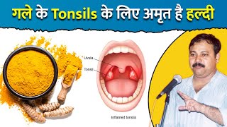 गले के टोंसिल Tonsils का नहीं करवाना होगा ऑपरेशन कुछ ही दिनों में ठीक करेगी हल्दी  Rajiv Dixit [upl. by Wappes]