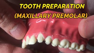 CROWN PREPARATION TUTORIAL MAXILLARY PREMOLAR [upl. by Shafer185]