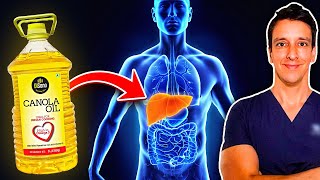 What CANOLA OIL does to your LIVER Influencers wont show you this [upl. by Ayanat285]