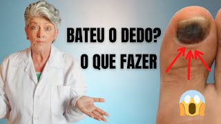 Como Tratar Hematoma na Unha [upl. by Nyleaj]