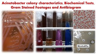 Acinetobacter colony characteristics Biochemical Tests Gram Stained Footages and Antibiogram [upl. by Drugi]