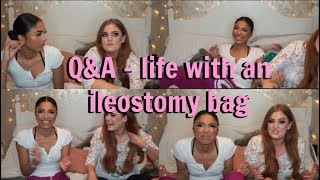 QampA  LIFE WITH AN ILEOSTOMY BAG [upl. by Riay698]