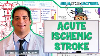 Acute Ischemic Stroke Etiology Pathophysiology Clinical Features Diagnostics Treatment [upl. by Aziar314]