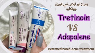 Best Acne Fighting Products  Medicated Acne Treatment  Dermatologist Recommended Creams [upl. by Alorac]