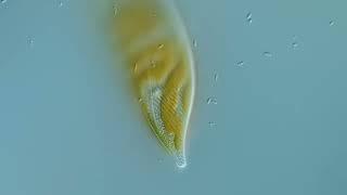 2 brackish Diatoms [upl. by Einal]