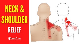 How to Fix Neck and Shoulder Pain FOR GOOD [upl. by Nevag]