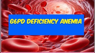 G6PD deficiency hemolytic anemia [upl. by Aicatsanna82]