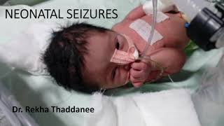 Neonatal Seizures  Pediatrics [upl. by Selemas800]