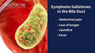 Gallbladder Cholelithiasis vs Cholecystitis vs Choledocholithiasis vs Cholangitis Made Easy [upl. by Esidnac]