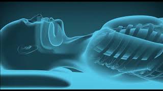 Inspire® Upper Airway Stimulation How It Works  BCH Sleep Medicine [upl. by Segalman]