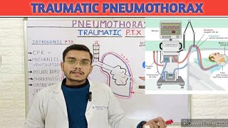 Traumatic pneumothorax pathophysiology in Hindi Iatrogenic non Iatrogenic  pneumothorax [upl. by Aseen]