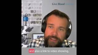 Is the Live Blood Analysis Microscope Easy to Use  Live Blood Analysis Training Course [upl. by Carnes]