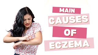 Top Causes of Eczema What Triggers This Common Skin Condition [upl. by Anhpad]