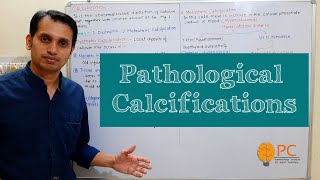 Pathologic Calcification Dystrophic and Metastatic Calcification  Calcification Pathophysiology [upl. by Kati]