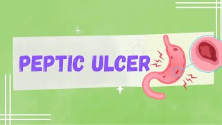 Peptic ulcer disease  English animation [upl. by Andromede]