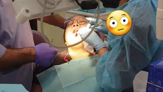 Odontectomy Procedure Wisdom Tooth [upl. by Awad313]