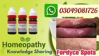 Fordyce spots  homeopathic treatments risk factors and symptoms explain by DrAbdul Manan [upl. by Alenairam]