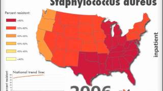 Methicillinresistant Staphylococcus aureus MRSA Inpatient [upl. by Hube]