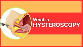 What is Hysteroscopy By Dr Mudita Jain [upl. by Horick]