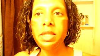 Jessners Chemical Peel African American  Day 4 [upl. by Eilsew]