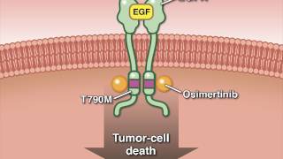 Osimertinib in Advanced Non–SmallCell Lung Cancer [upl. by Eynaffit]