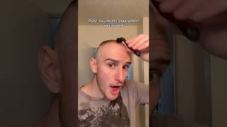 We all start somewhere hair hairgrowth hairtransformation hairtransplant buzzcut bald wig [upl. by Cordula]