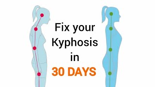 Fix your Kyphosis and hunched back in 30 days  NO EQUIPMENT  fitmarym [upl. by Pazice]