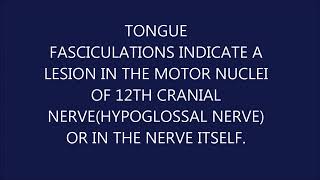 TONGUE FASCICULATIONS ALS [upl. by Souza]