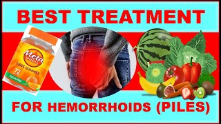 Best Treatment for hemorrhoids piles [upl. by Yerkovich]