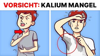 3 Anzeichen von akutem KaliumMangel [upl. by Latif810]